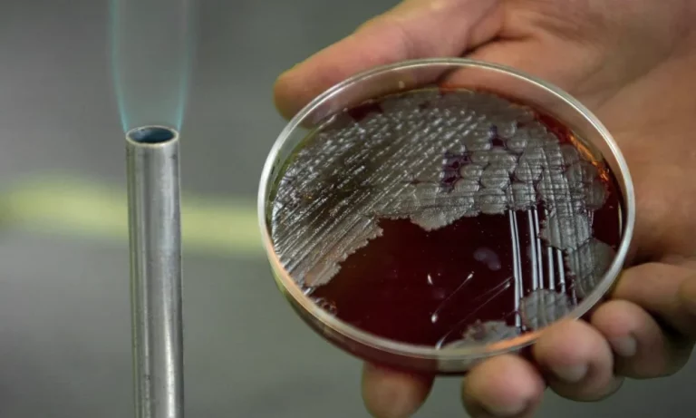 Anthrax: All You Need To Know About Deadly Disease In Town