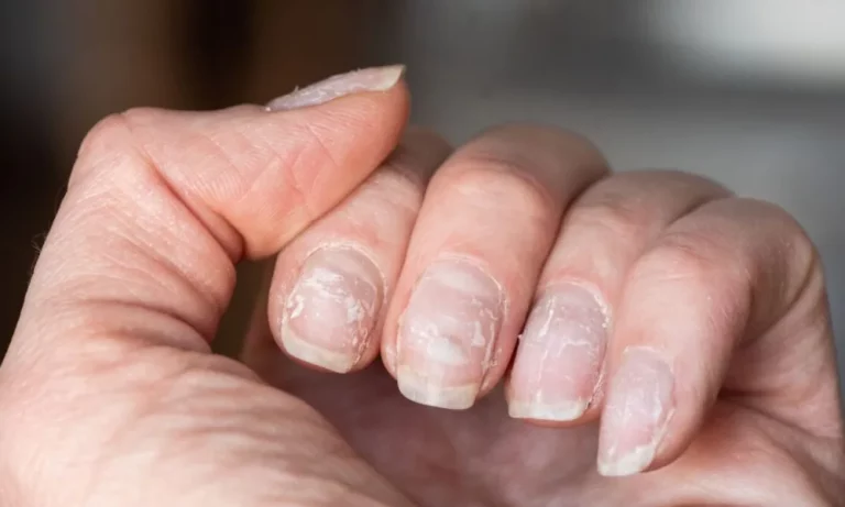 Side Effects Of Nail Polish Women Must Know