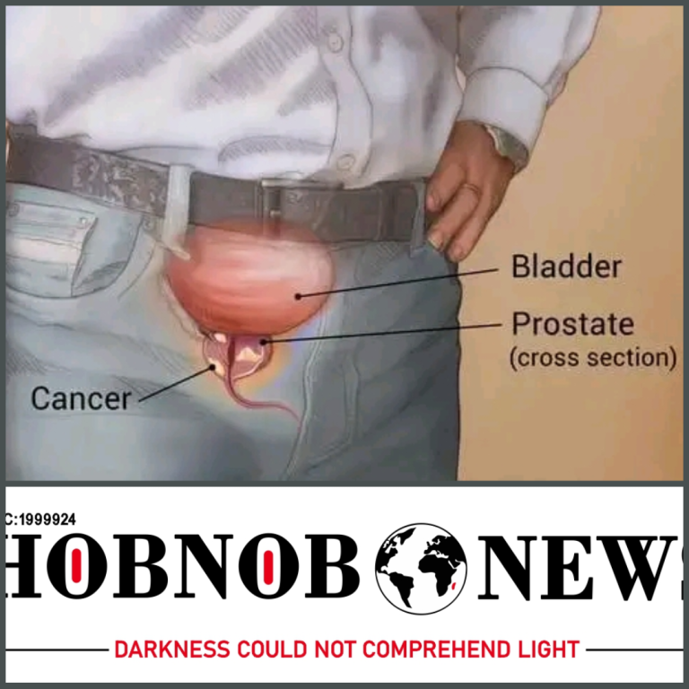 Be sexually active to prevent prostate cancer, experts advise men