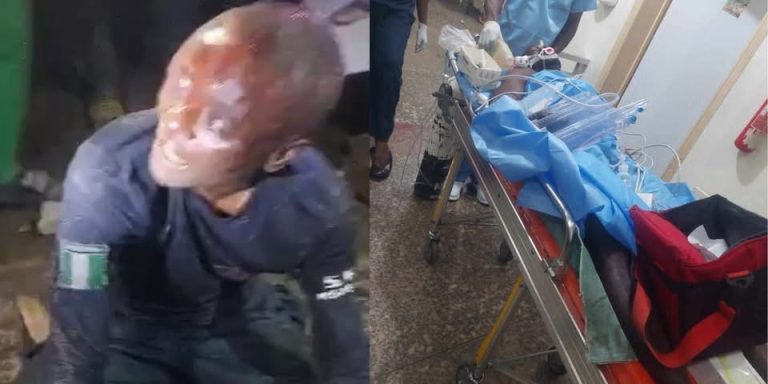Policeman Allegedly Shoots Civilian, Abandons Him at Hospital