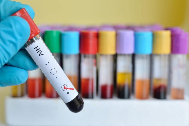 Rivers, Benue and Akwa Ibom Lead Nigeria’s HIV Burden in NACA’s 2024 Spectrum Estimates