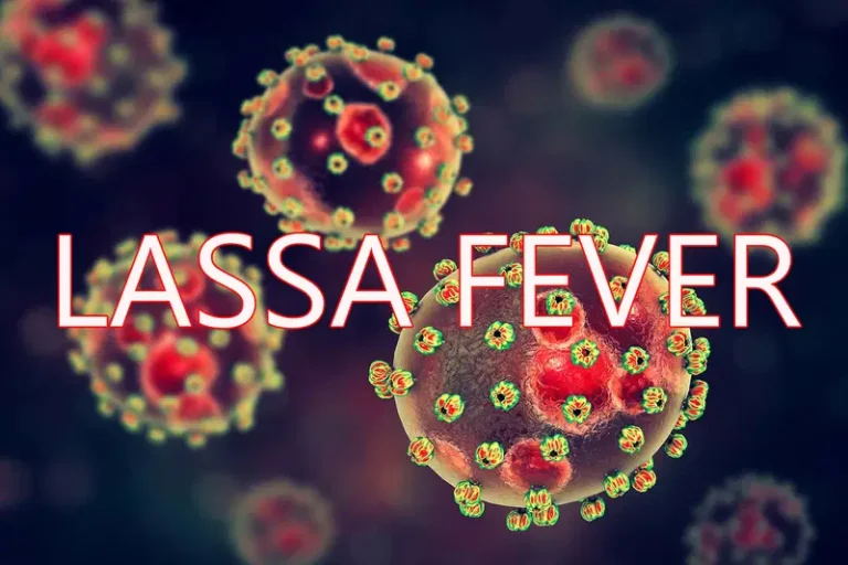 Lassa Fever Alert: Kano Records First Confirmed Case, Authorities Race to Contain Spread